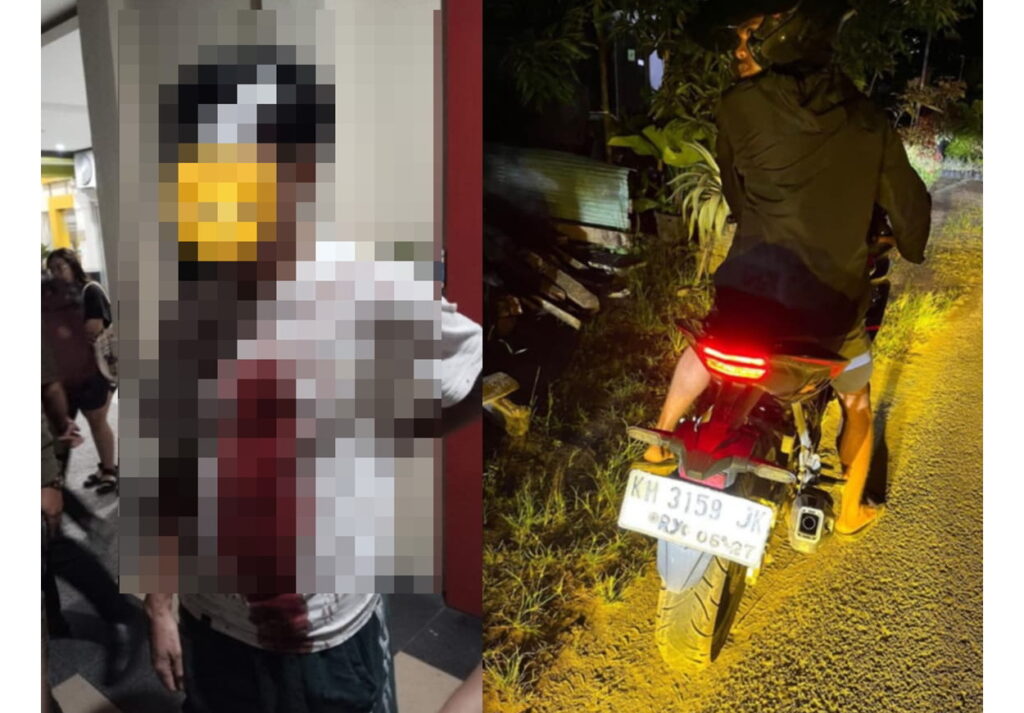 Driver Car Online Bocor Kepala, Dikeroyok Pemotor Mabuk di Jalan Yos Sudarso Ujung